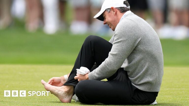 Rory McIlroy ‘totally fine’ for US PGA Championship after toe issue Rory McIlroy attending to his sore toe while on the third fairway at Aronimink Golf Club